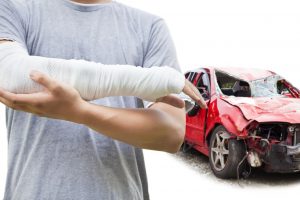 hand with bandage due to car accident